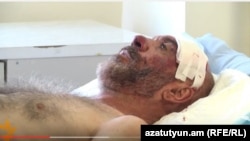 Смбат Акопян в больнице, 21 сентября 2015 г.